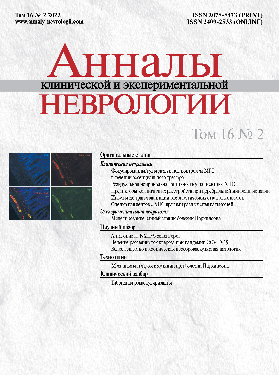 Подтверждена эфективность отечественной вакцины для профилактики COVID‑19 — 85,2%